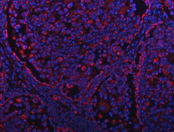 a05981 2 ndufa13 primary antibodies if testing 5