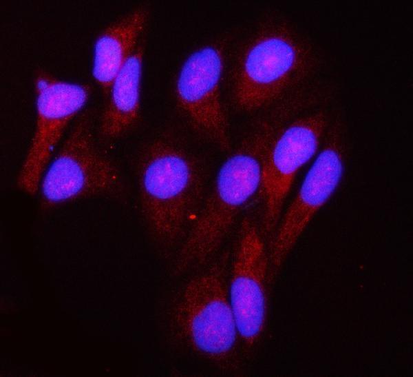 a05981 2 ndufa13 primary antibodies if testing 6