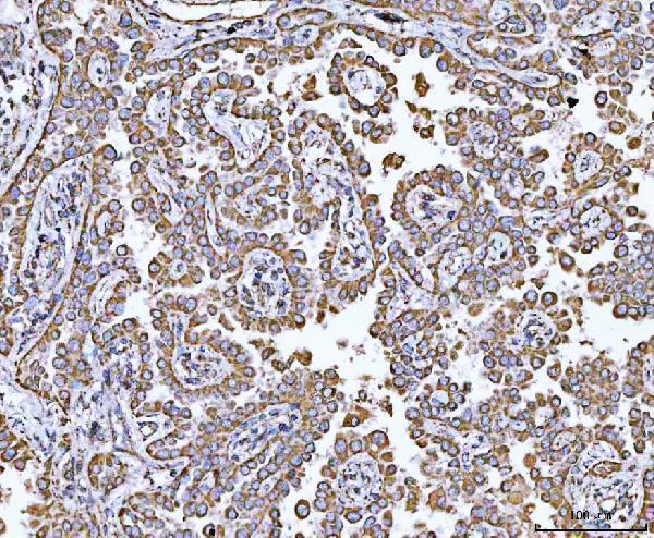 a05981 2 ndufa13 primary antibodies ihc testing 2