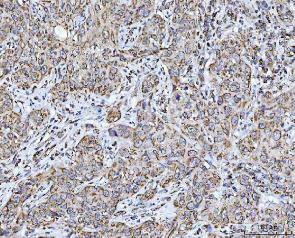 a05981 2 ndufa13 primary antibodies ihc testing 3