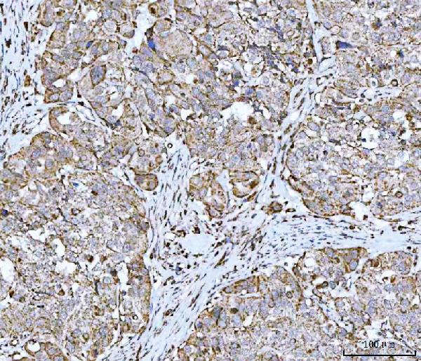 a05981 2 ndufa13 primary antibodies ihc testing 4