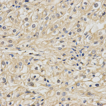 a05981 ndufa13 primary antiboties wb testing 2