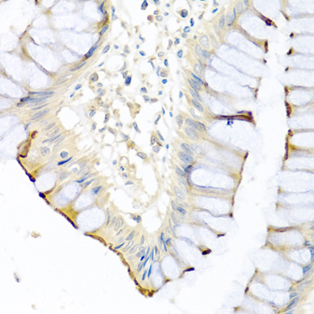 a05985 2 cpa1 primary antiboties if testing 2