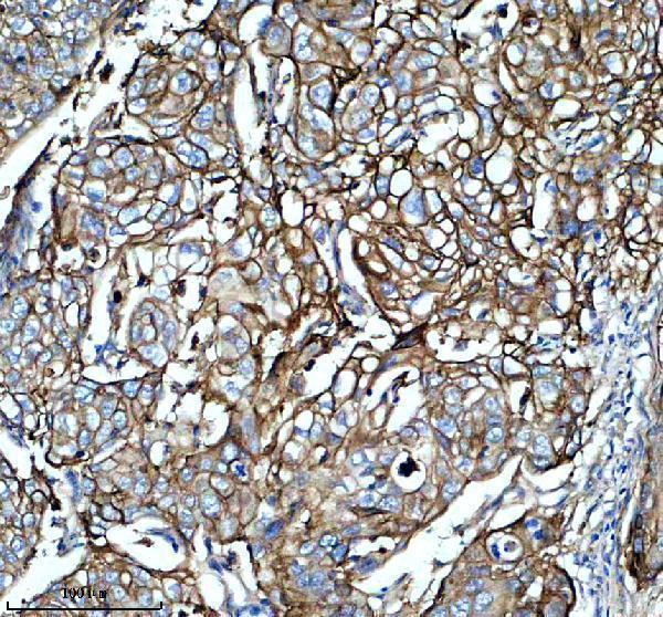 a05986 3 ifnlr1 primary antibodies ihc testing 1