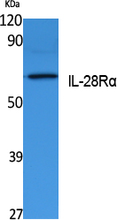 Western Blot analysis of extracts from K562 cells, using IL-28Rα Polyclonal Antibody