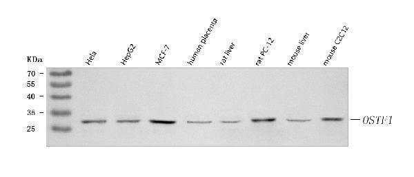 Western blot analysis of OSTF1 using anti-OSTF1 antibody (A05988-1)