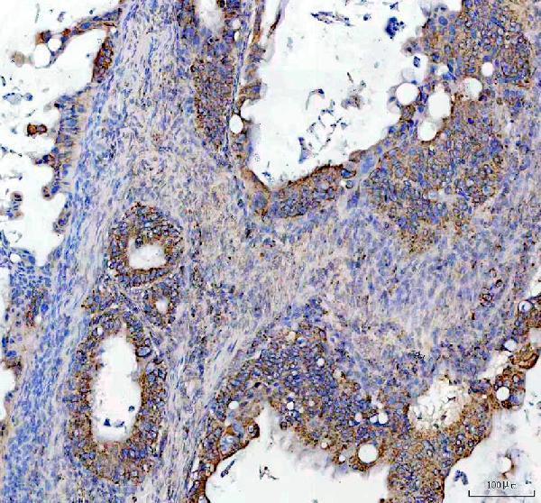IHC analysis of SOCS5 using anti-SOCS5 antibody (A05989-1)