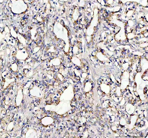 IHC analysis of SOCS5 using anti-SOCS5 antibody (A05989-1)