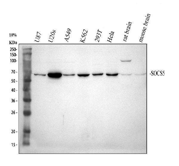 Western blot analysis of SOCS5 using anti-SOCS5 antibody (A05989-1)