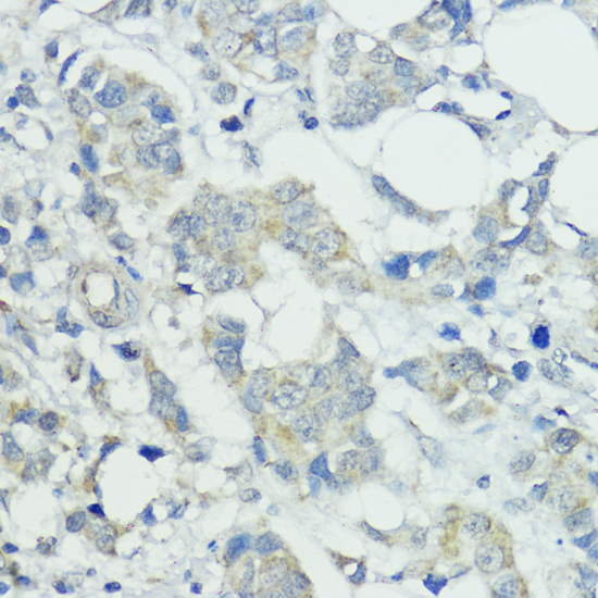a05989 socs5 primary antiboties ihc testing 2