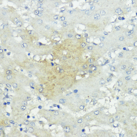 a05989 socs5 primary antiboties ihc testing 3