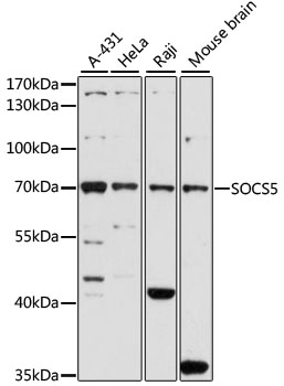 a05989 socs5 primary antiboties wb testing 1