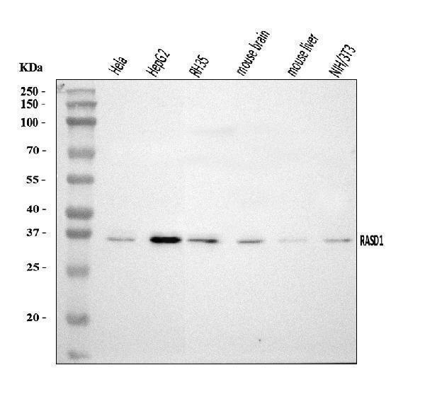  Western blot analysis of Dexras1/RASD1 using anti-Dexras1/RASD1 antibody (A05991-1)