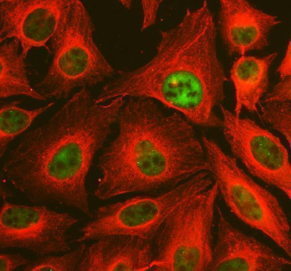 IF analysis of TAF6 using anti-TAF6 antibody (A05993-1) and anti-Beta Tubulin antibody (M01857-3)