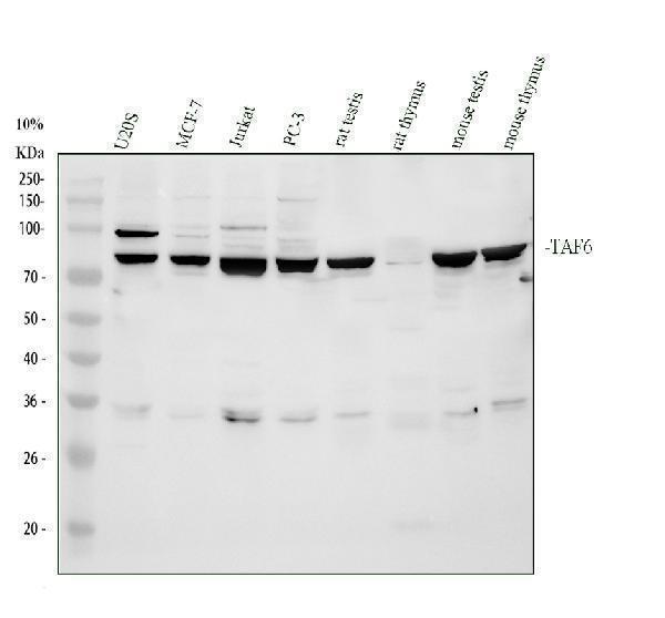 Western blot analysis of TAF6 using anti-TAF6 antibody (A05993-1)