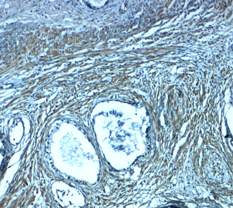 a05994 1 pmepa1 primary antibodies ihc testing 2