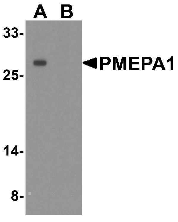 a05994 1 pmepa1 primary antibodies wb testing 1