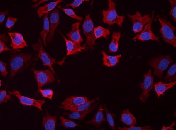 IF analysis of SLC25A1 using anti-SLC25A1 antibody (A05995-1)