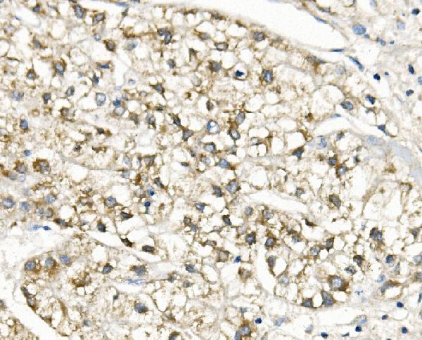 a05995 2 slc25a1 primary antibodies ihc testing 2