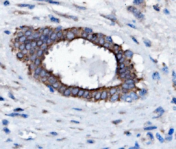 a05995 2 slc25a1 primary antibodies ihc testing 3