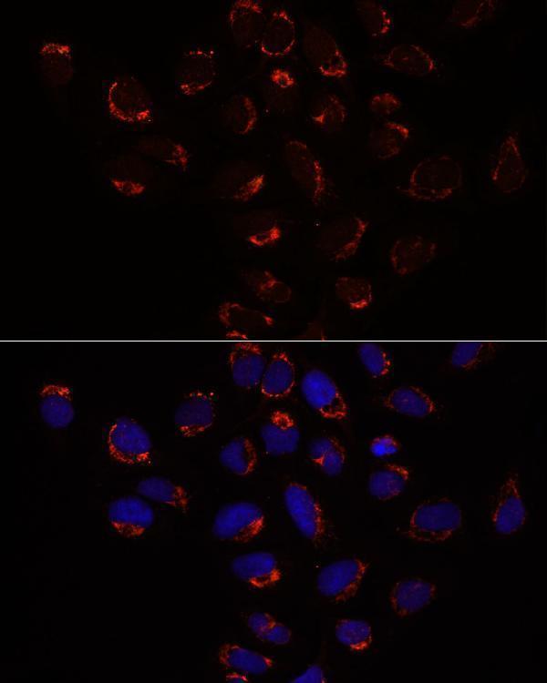 Immunofluorescence analysis of U2OS cells using SLC25A1 antibody  at dilution of 1:100