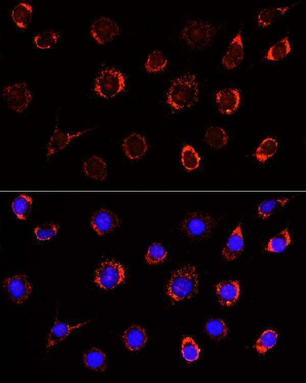 Immunofluorescence analysis of L929 cells using SLC25A1 antibody  at dilution of 1:100
