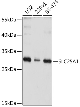 Western blot analysis of extracts of various cell lines, using SLC25A1 Rabbit pAb  at 1:1000 dilution