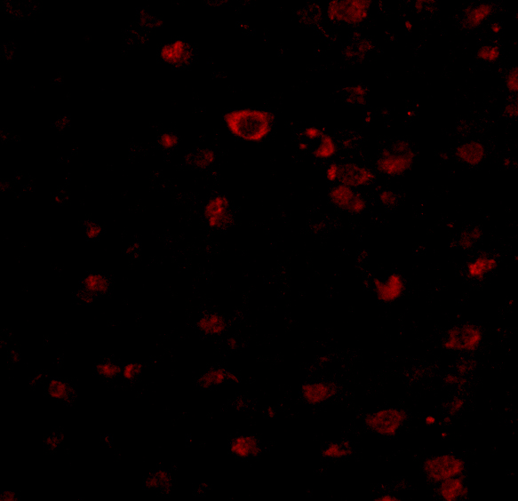 a05997 1 brsk1 primary antibodies if testing 3