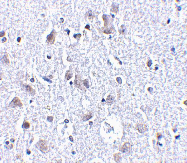 a05997 1 brsk1 primary antibodies ihc testing 2