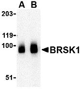 a05997 1 brsk1 primary antibodies wb testing 1