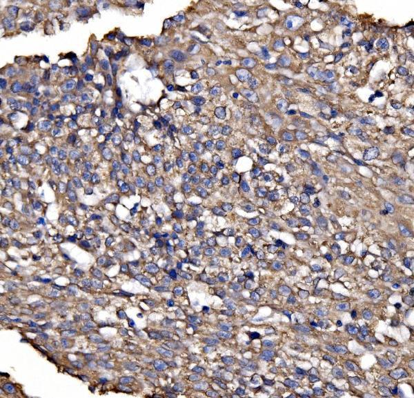  IHC analysis of BRSK1 using anti-BRSK1 antibody (A05997-2)