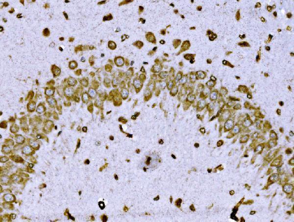 a05997 2 brsk1 primary antibodies ihc testing 4