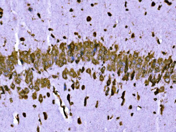 a05997 2 brsk1 primary antibodies ihc testing 5