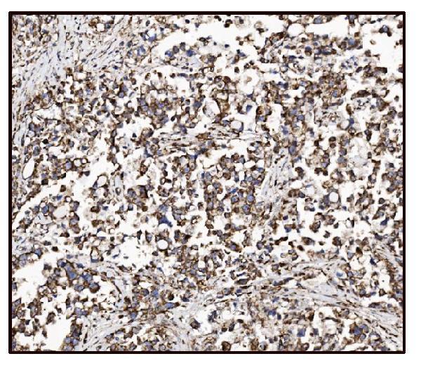 a05998 1 got2 primary antibodies ihc testing 10_1