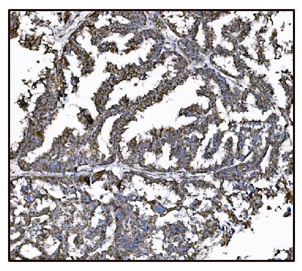 a05998 1 got2 primary antibodies ihc testing 11_1