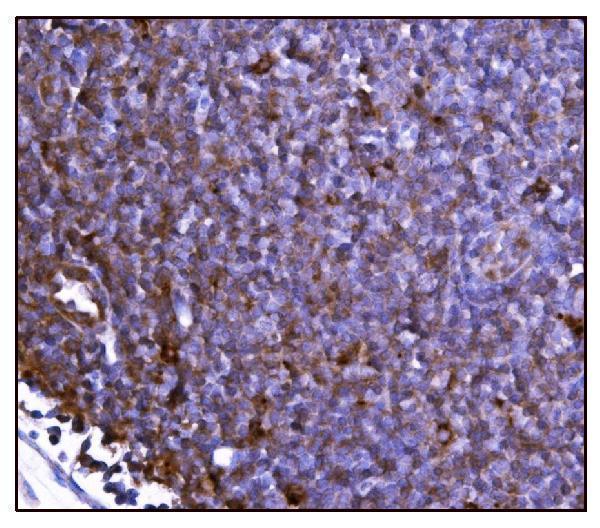 a05998 1 got2 primary antibodies ihc testing 13_1