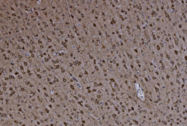 a05998 1 got2 primary antibodies ihc testing 2