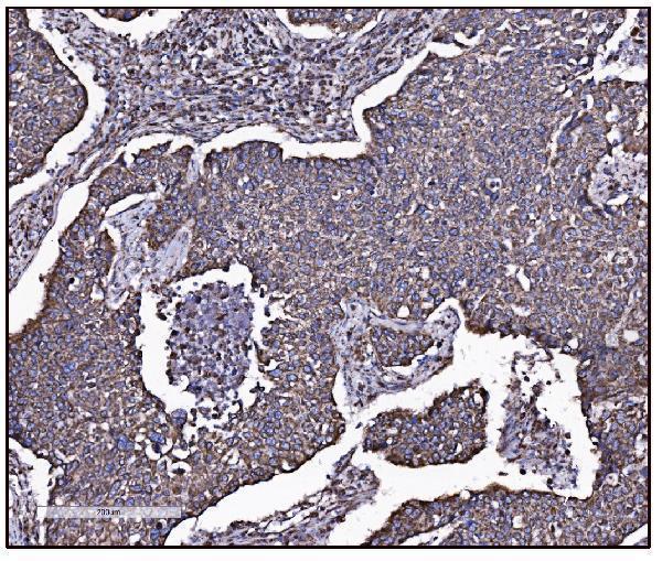 a05998 1 got2 primary antibodies ihc testing 6_1