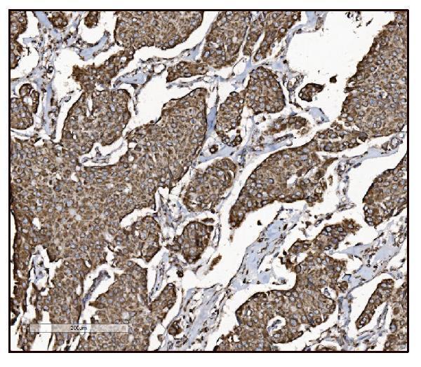 a05998 1 got2 primary antibodies ihc testing 8_1