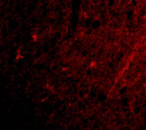 a06001 1 grik1 primary antibodies if testing 3
