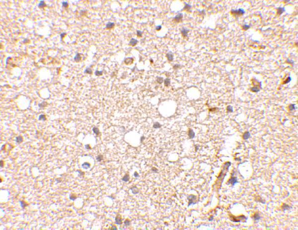 a06001 1 grik1 primary antibodies ihc testing 2