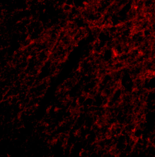 a06001 grik1 primary antibodies if testing 3