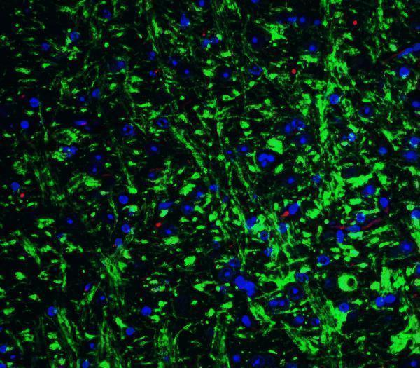 a06001 grik1 primary antibodies if testing 5