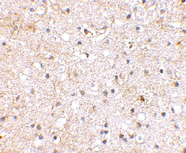 a06001 grik1 primary antibodies ihc testing 2