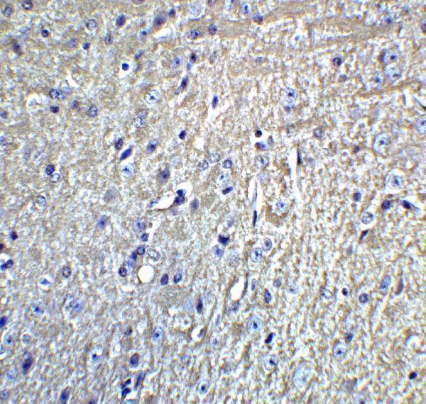 a06001 grik1 primary antibodies ihc testing 4