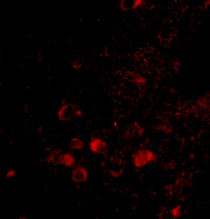 a06004 1 elovl6 primary antibodies if testing 3