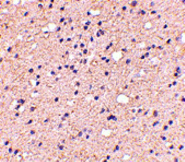 a06004 1 elovl6 primary antibodies ihc testing 2