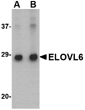 a06004 1 elovl6 primary antibodies wb testing 1