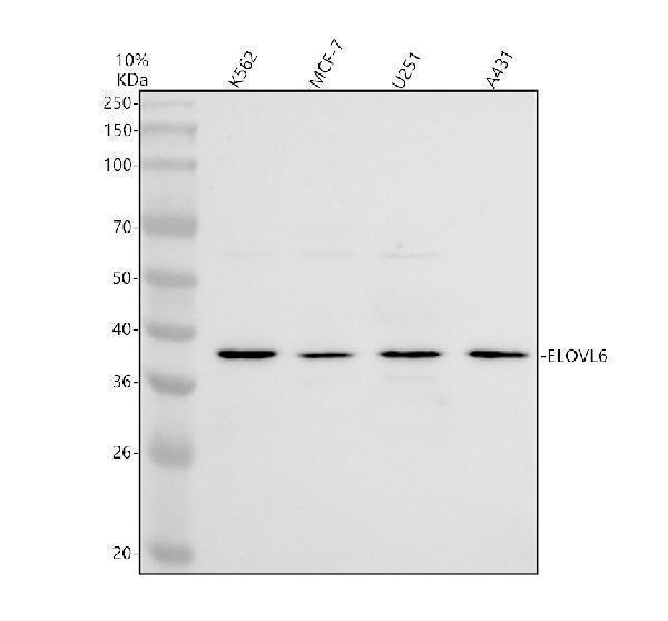 Western blot analysis of ELOVL6 using anti-ELOVL6 antibody (A06004-2)