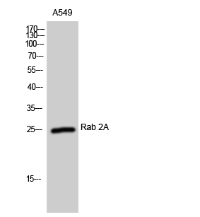 Western blotting validation for Anti-Rab 2A Antibody A06007-1
Western Blot (WB) analysis of A549 cells using Rab 2A polyclonal antibody